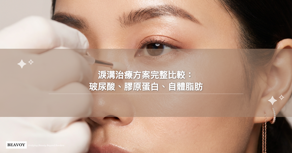 淚溝治療方案完整比較:玻尿酸、膠原蛋白、自體脂肪一次搞懂